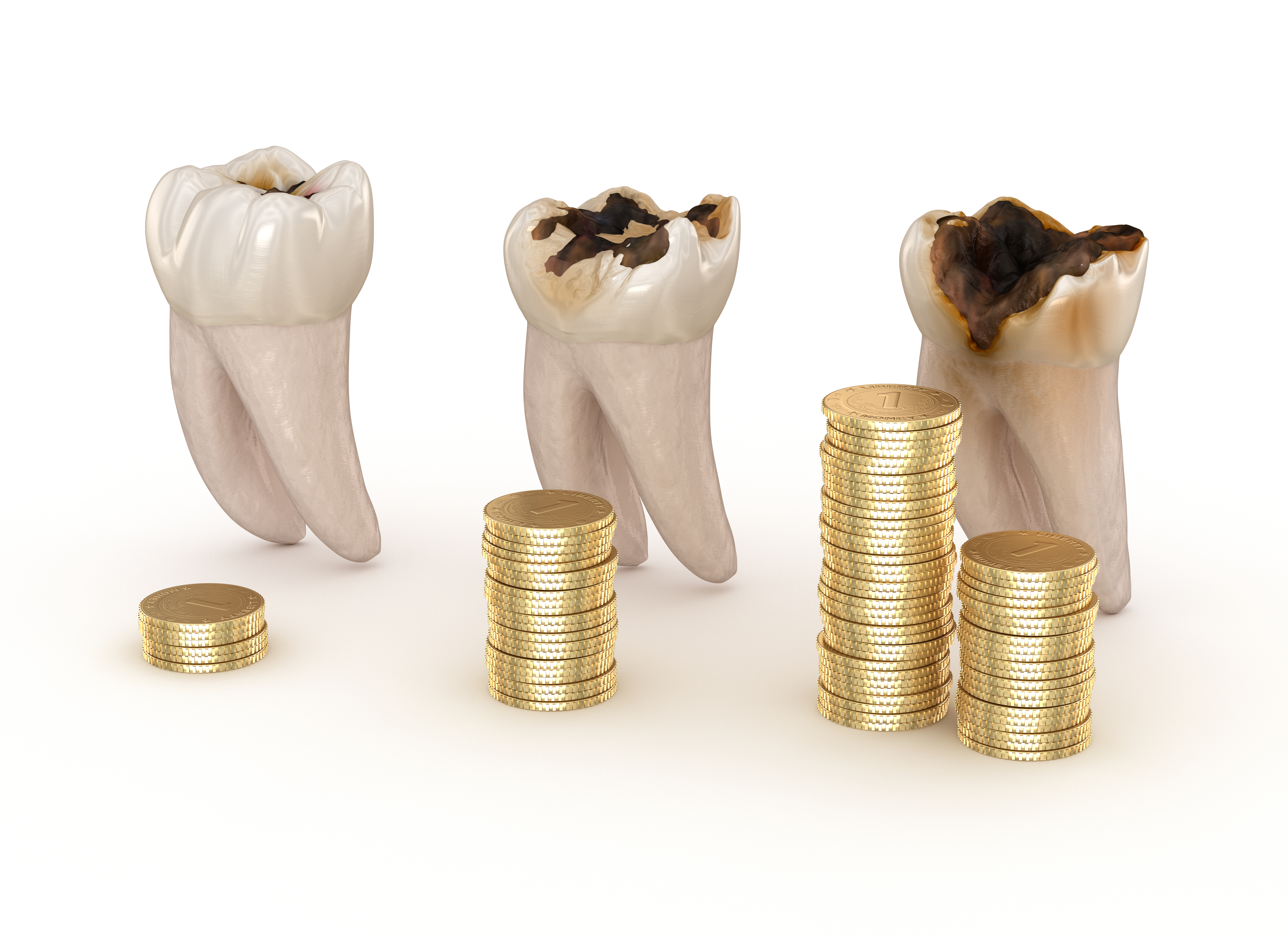 Dental cost help - instasmile