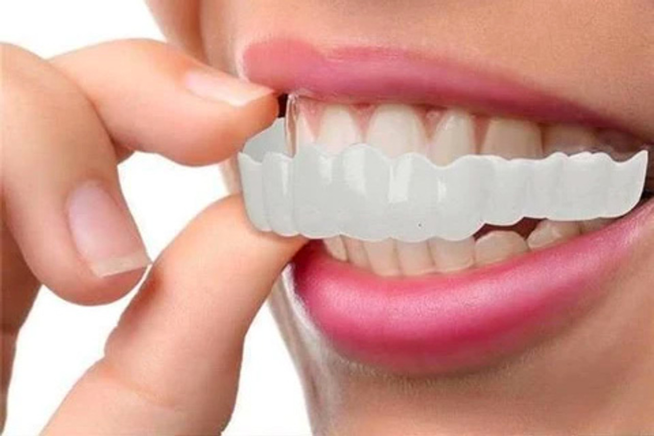 how-long-do-clip-on-veneers-last.jpg