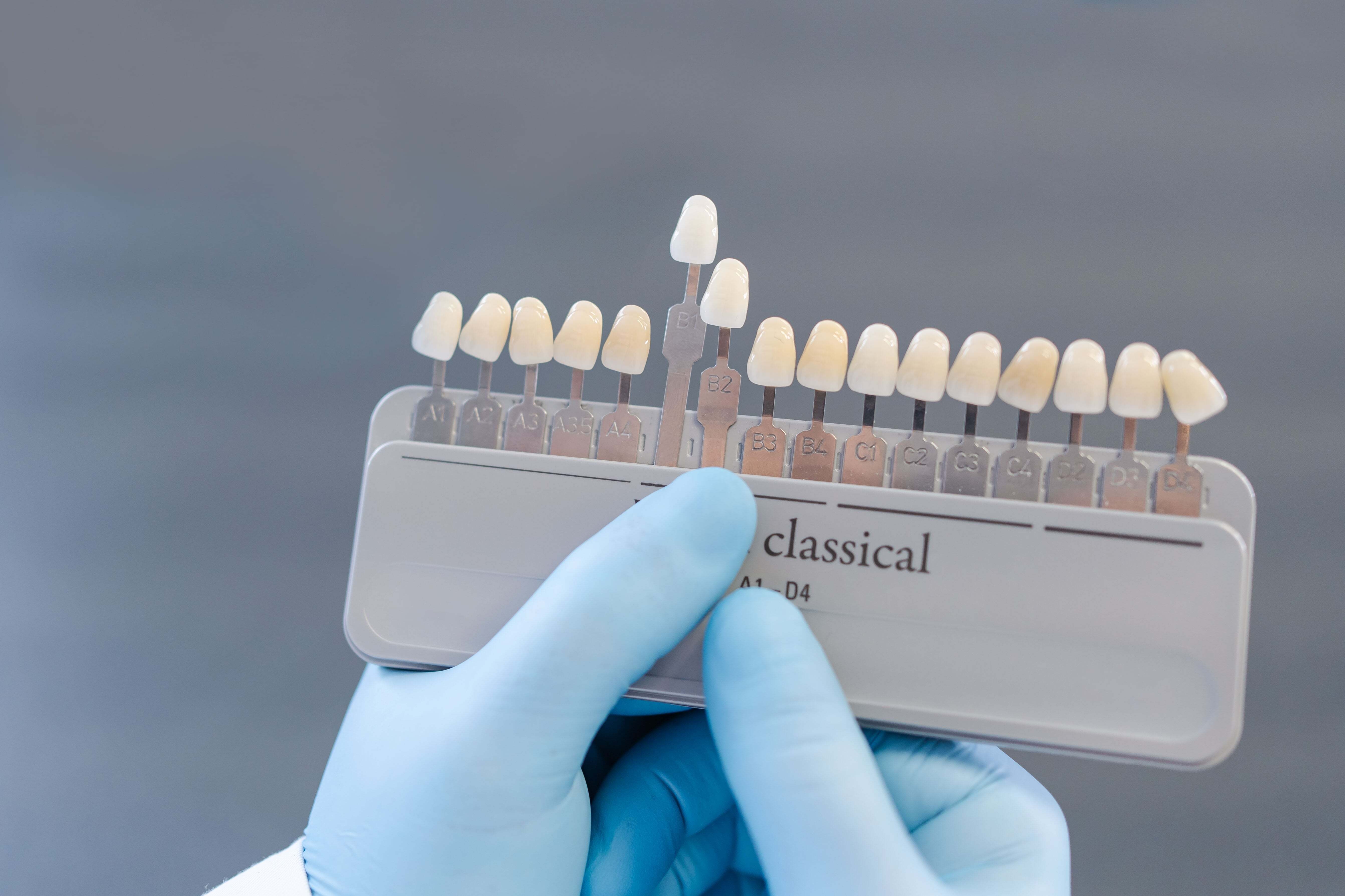 whitest tooth shade - instasmile