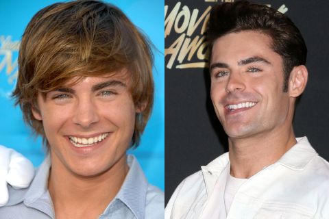Zac Efron Teeth - instasmile